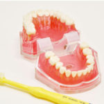 全般的な歯科治療